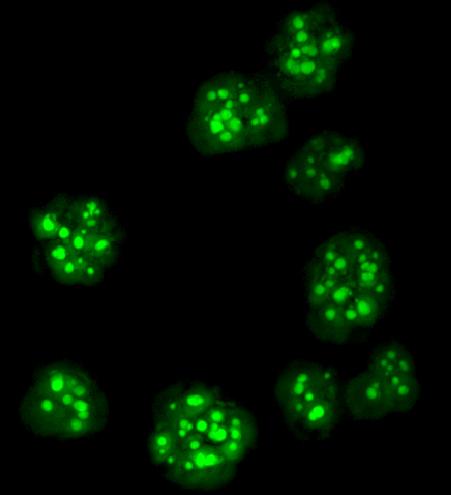 Vip1-1 Cells