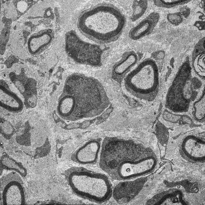 Cross-Section Axon
