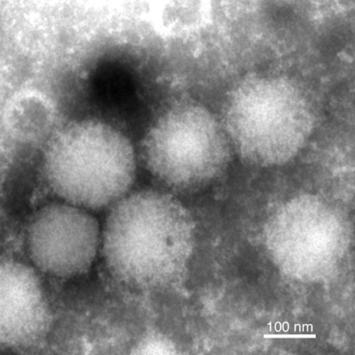 Transmission electron micrograph of the Yezo virus, a type of orthonairovirus
