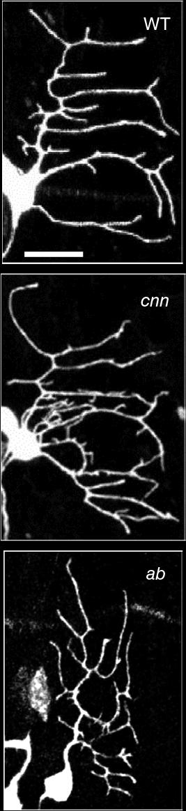Centrosomin Acts to Limit Dendritic Branching