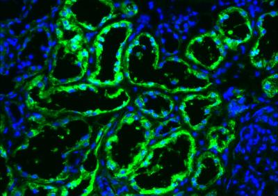 Ametabolic Enzyme In An Unexpected Role