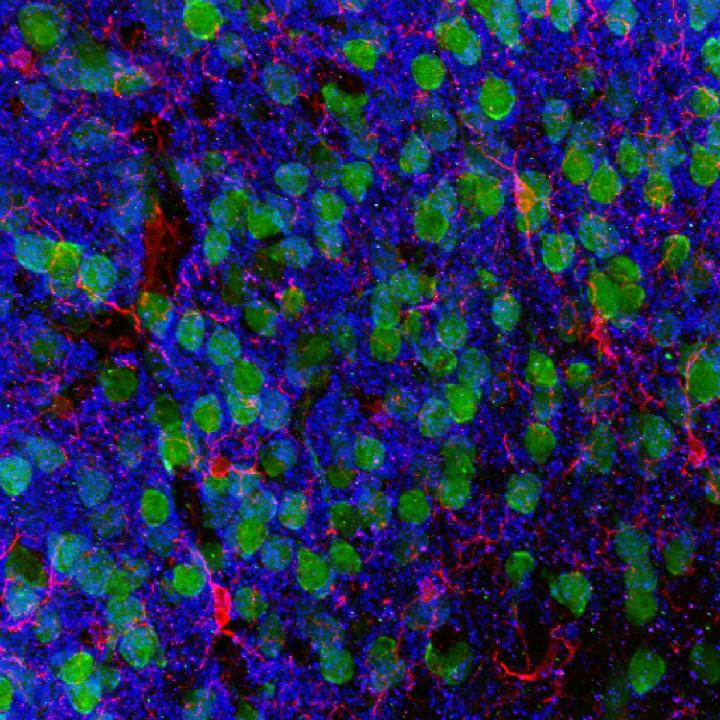Imaging the Brain
