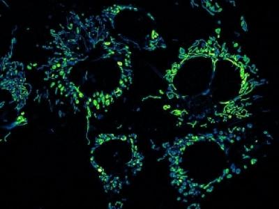 Nanocomposite Particles