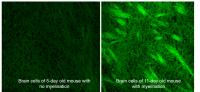 Fat Formation in Brain Cells of Developing Mice