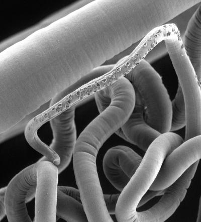 Parasitic worms (1 of 2)