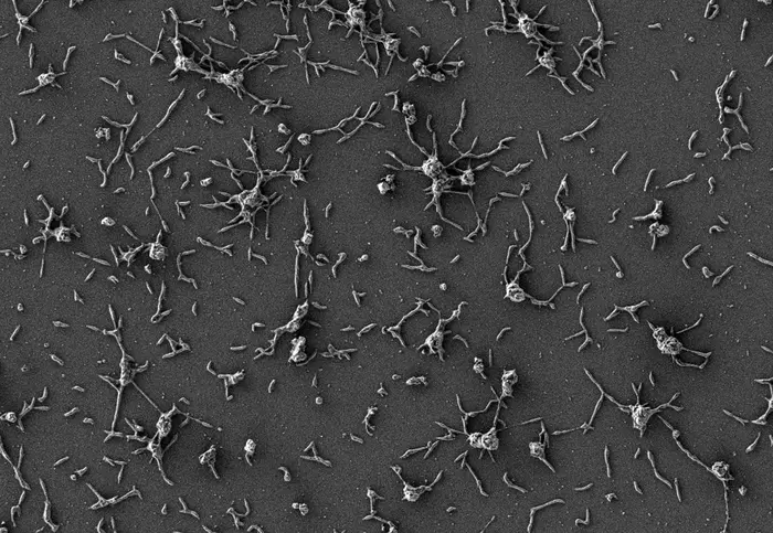 SEM or Mycoplasma pneumoniae