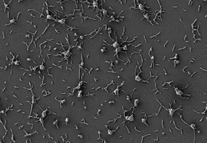 SEM or Mycoplasma pneumoniae