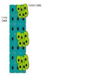 Path to Tumor Destruction
