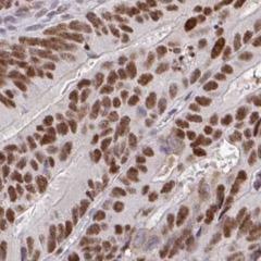 The JDP2 Gene
