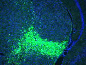 CGRP Neurons