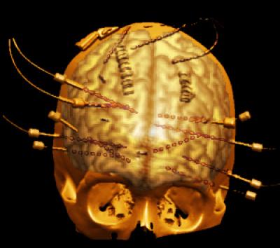 Brain Image