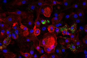 Microscopy image showing senescent macrophages