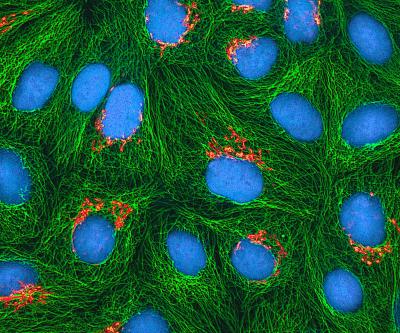 Multiphoton Fluorescence Image of Cultured HeLa Cells