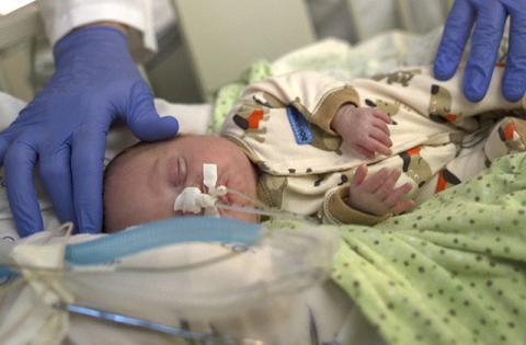Premature Baby