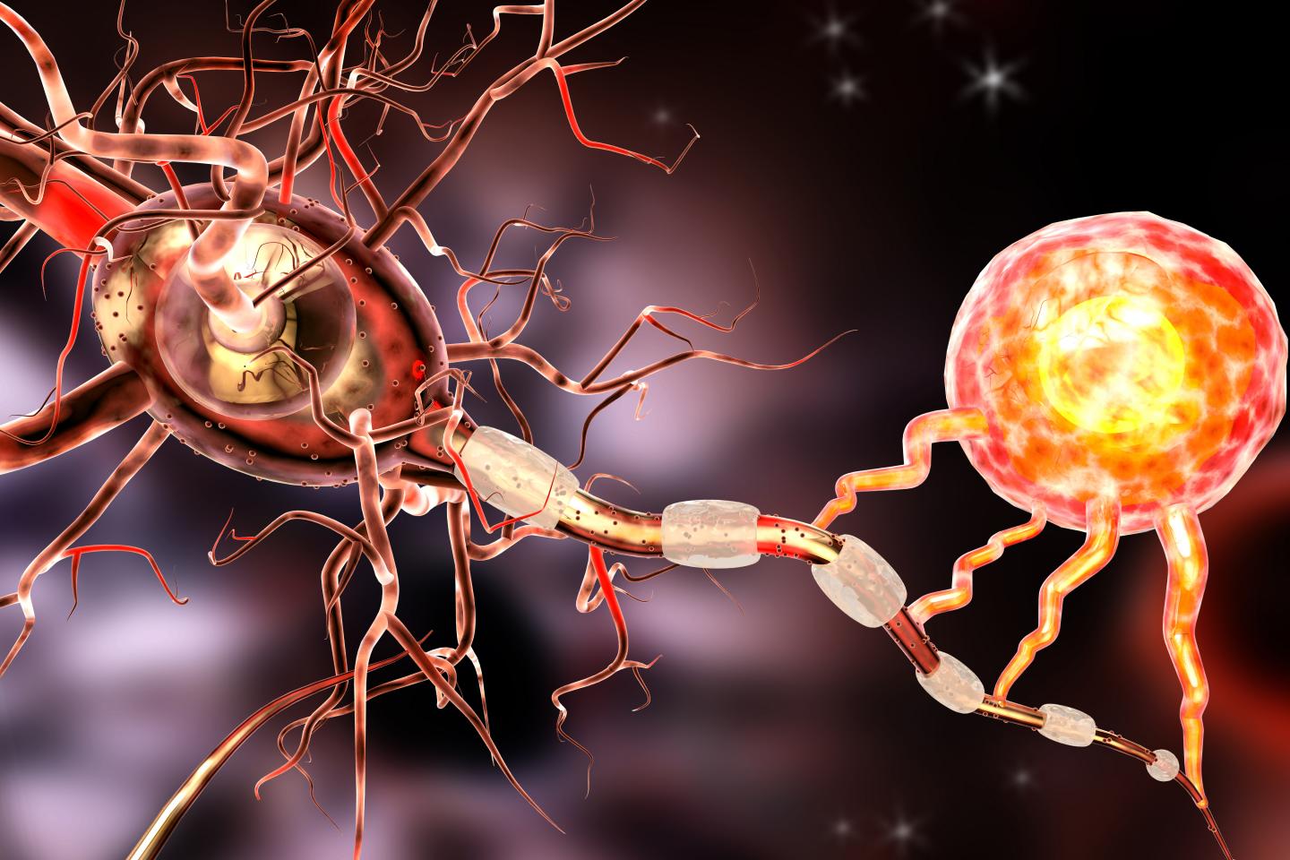 Treatment hope for Alzheimer's