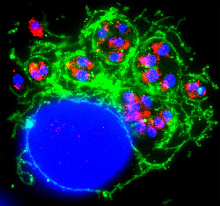 <em>Toxoplasma</em>