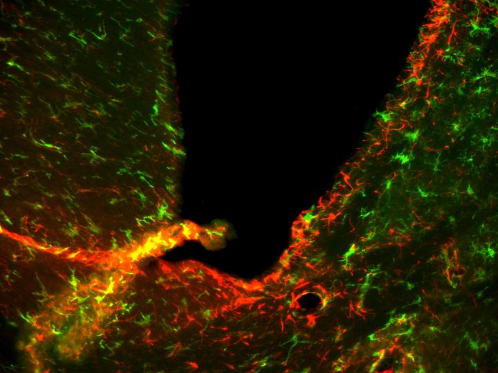 MS Mouse Brain