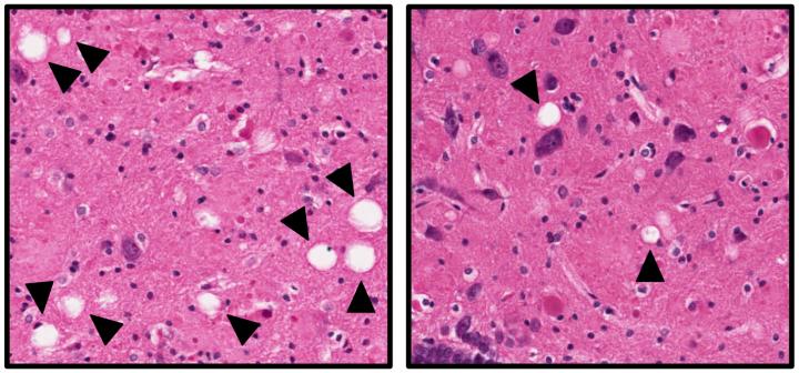 Saving Neurons