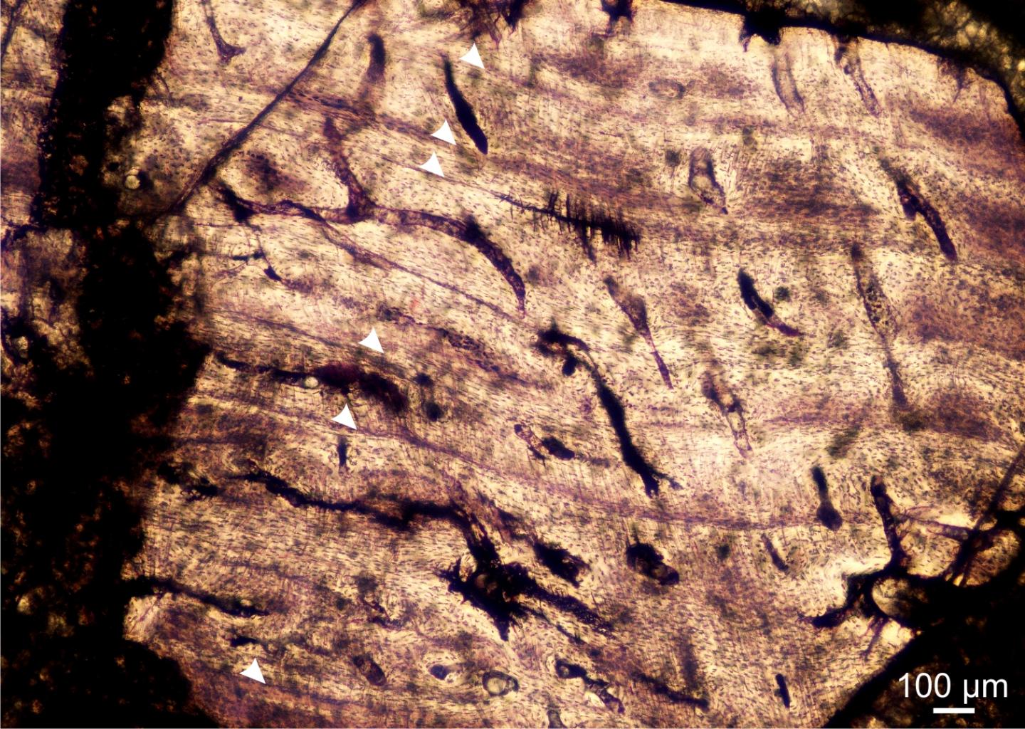 Growth Rings