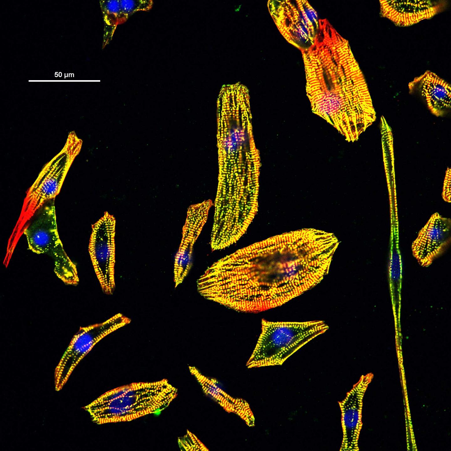 Human Cardiomyocytes