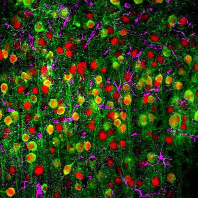 Neurons in the Auditory Cortex