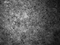 Beating Heart Muscle Cells