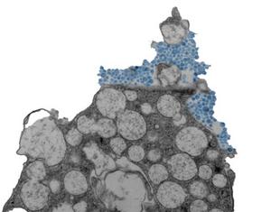 Human nasal epithelial cell releasing rhinovirus