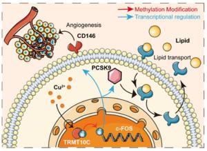 Disulfiram fights liver cancer by regulating lipid metabolism and angiogenesis