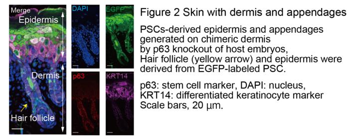 Figure 2 Skin with dermis and appendages