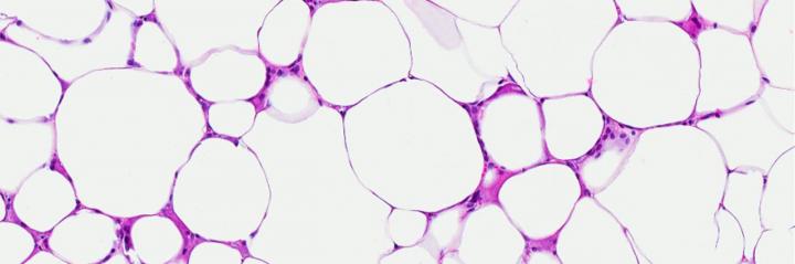 Natriuretic Peptide Signaling in Metabolism