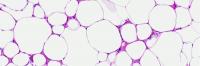 Natriuretic Peptide Signaling in Metabolism