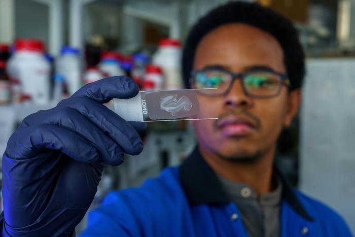 Daniel Martínez Pérez holds tissue sample