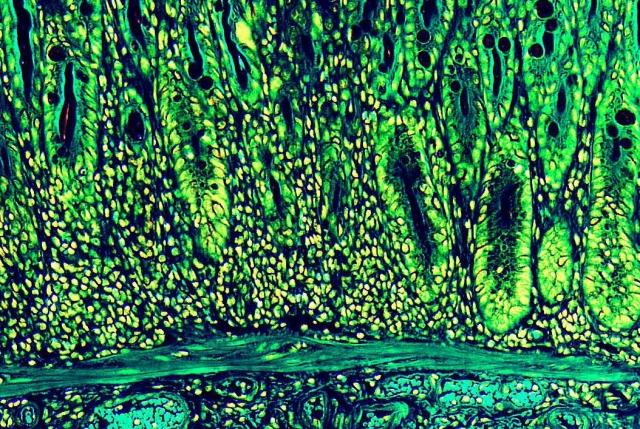 The Intestinal Barrier