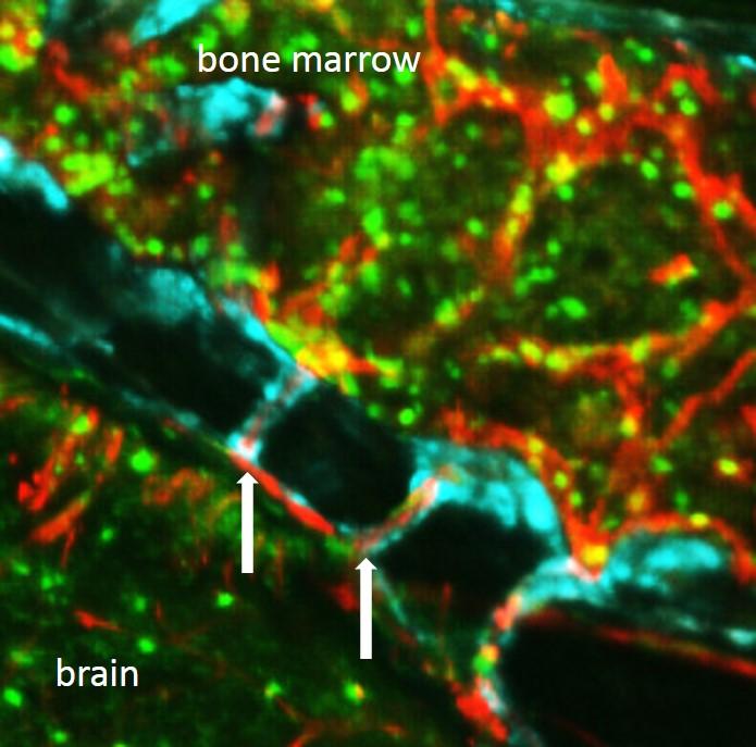 Scientists Dig up Tunnels in the Skull