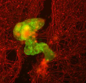 Superbot healing a neuron field