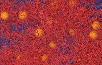 image of filaments and microscopic beads