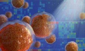 20251106_Zaugg_Cancer_TumorCells