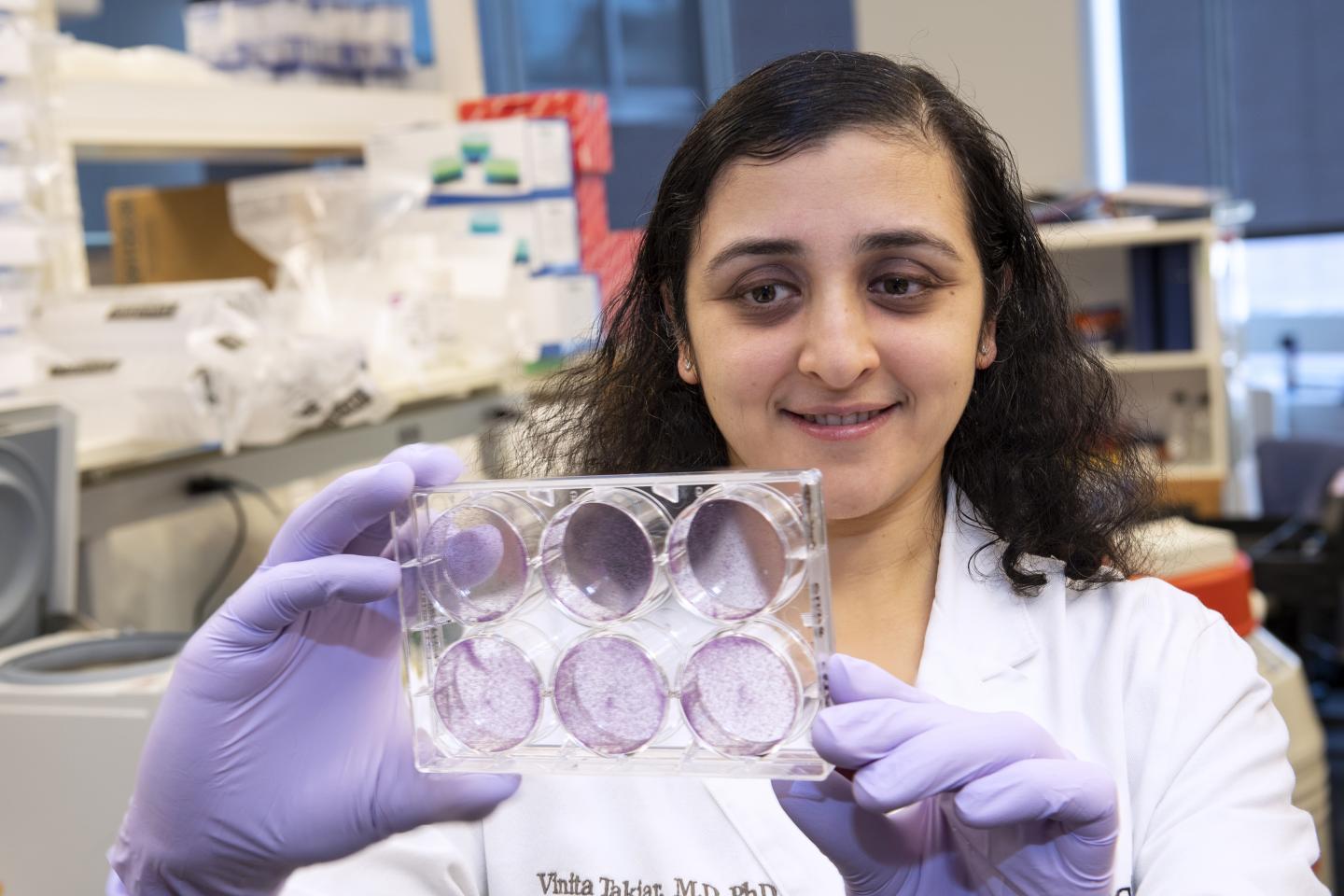 Vinita Takiar, M.D., Ph.D., University of Cincinnati Academic Health Center