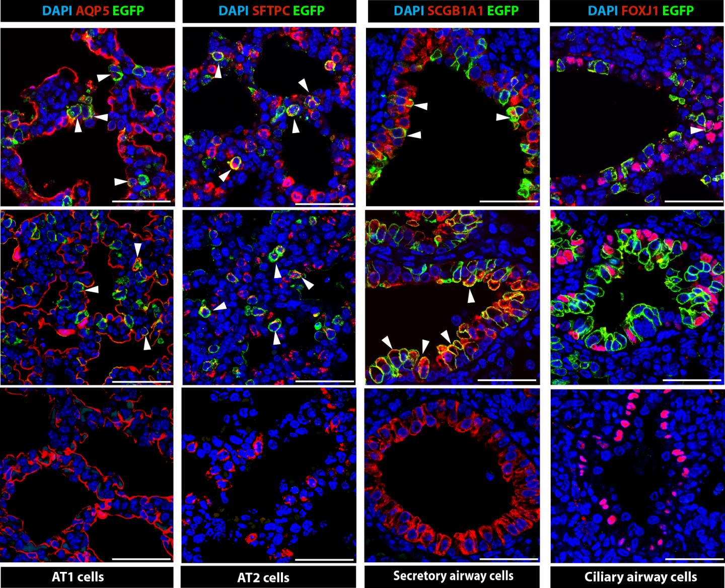 Gene Editing in the Mouse Womb Corrects Inherited Lung Disease in Mouse Fetuses (1 of 1)