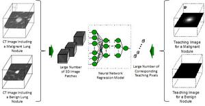 Ultra-lightweight artificial intelligence model for efficient cancer diagnosis.
