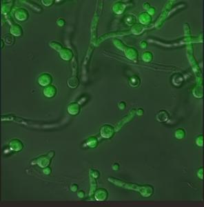 Aspergillus fumigatus under stress