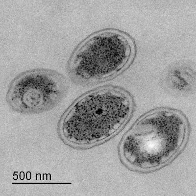 <em>Chlorobium phaeoferrooxidans</em>
