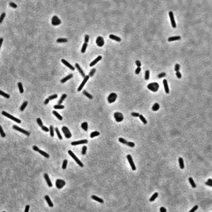 Phase contrast microscopy