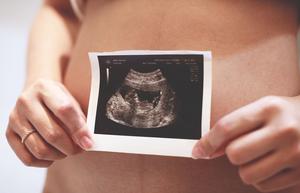 Preventing spontaneous preterm delivery using probiotics
