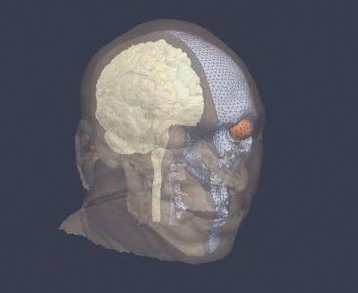 Computer Simulation