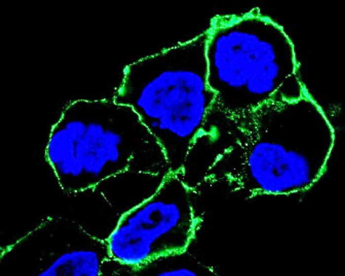 Targeted cancer therapy