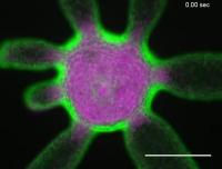 <em>Hydra vulgaris</em> Opening its Mouth (2 of 2)