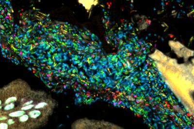 Bacteria in Gnotobiotic Mouse Colon