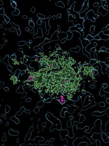 An Imaris reconstruction illustrating Lecanemab taken up by human microglia