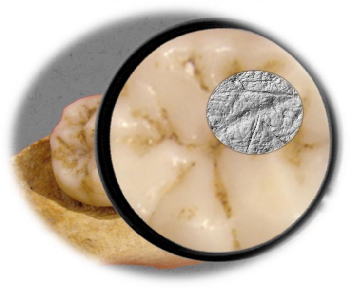 Microscopic Image of Fossilized Ancient Human Molar